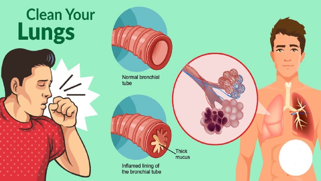 How To Get Rid Of Phlegm And Mucus In Chest &  Throat ...