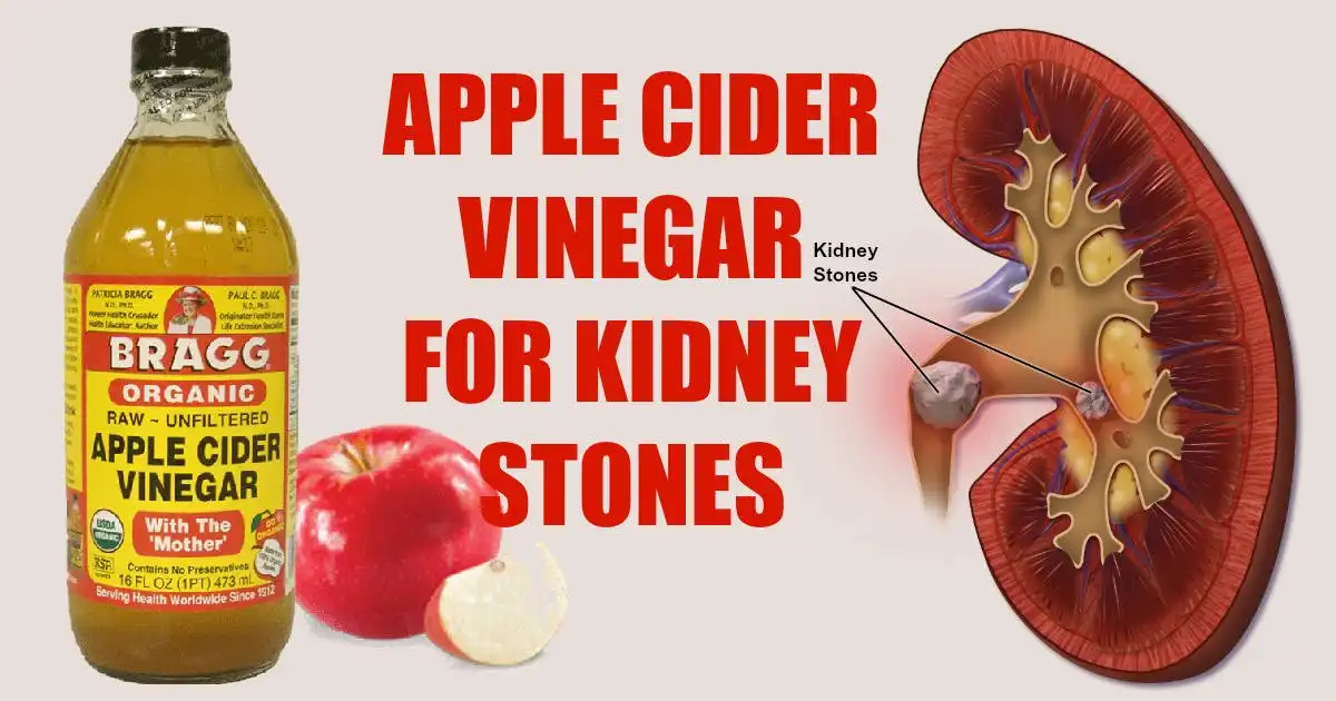Is Apple Cider Vinegar Bad For Kidneys