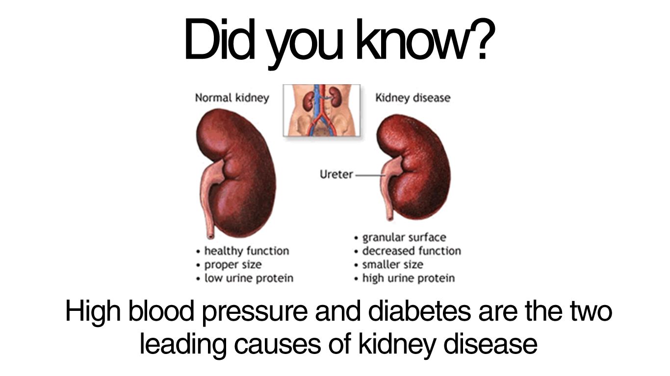 #WednesdayLearn: Chronic Kidney Disease (CKD) refers to a ...