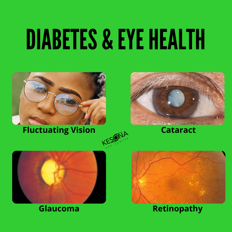 What you should know about diabetes and eye health